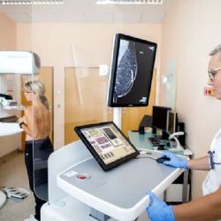 Klientky VZP budou moci od července na mamografii i bez žádanky